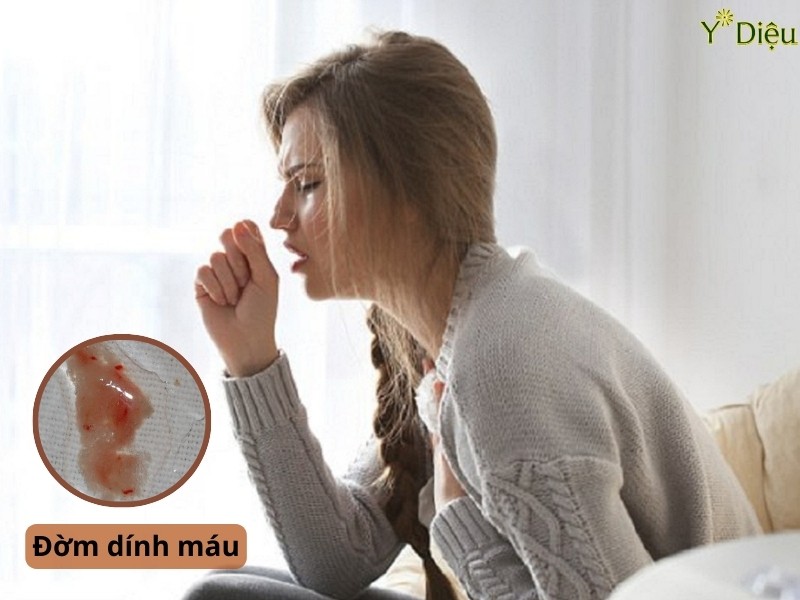 Máu có thể không xuất hiện riêng biệt mà hòa lẫn trong đờm